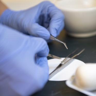 tweezers being held with gloves